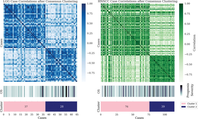 Case-based consensus clustering of random radiomics features associated with overall survival (OS) in The Cancer Genome Atlas Low-Grade Glioma (left) and head and neck squamous cell carcinoma (HNSCC) (right) data sets. Despite sharp feature distribution differences, as seen in the heat maps, no statistically significant difference in outcome distribution exists between the assigned clusters. LGG = low-grade glioma.