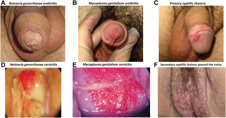 Fig. 1