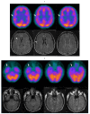 Fig. (1)