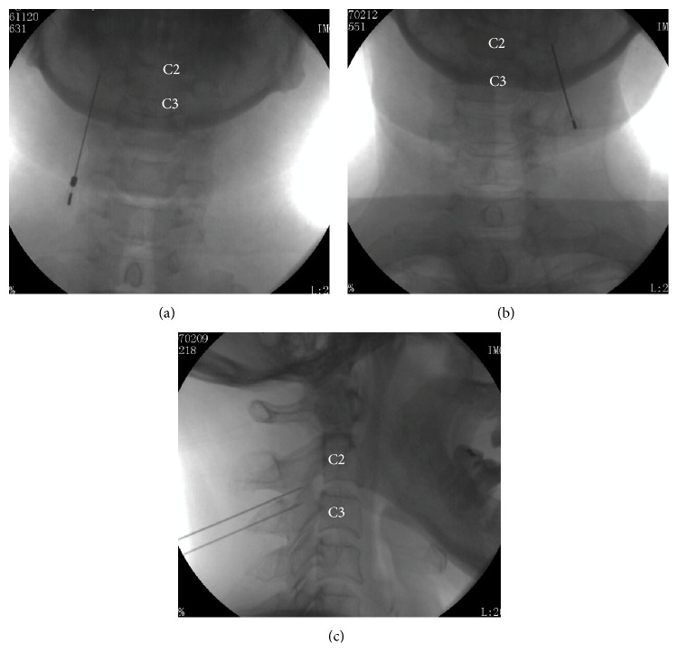 Figure 2