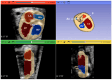 Figure 24
