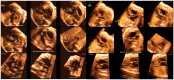 Figure 19