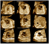 Figure 20