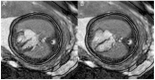 Figure 25