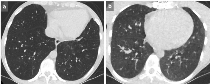 Figure 13. 