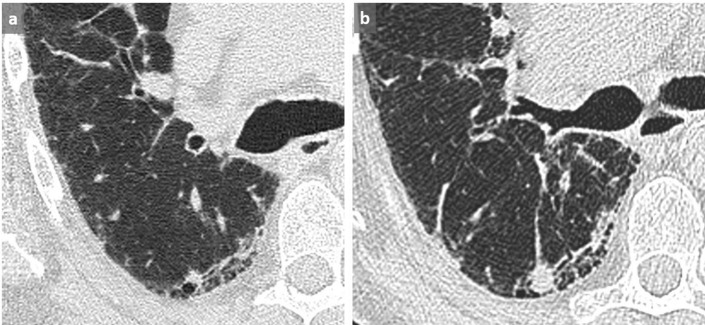 Figure 15. 