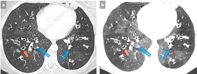 Figure 12. 