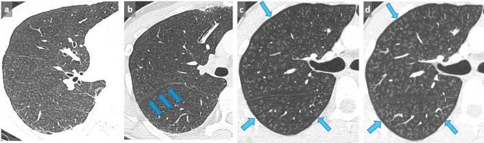 Figure 10. 