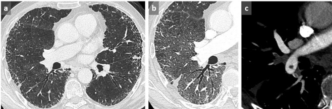 Figure 14. 