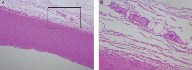 Fig. 3