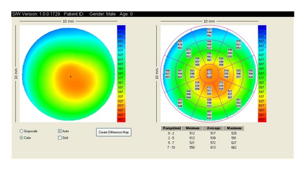 Figure 12