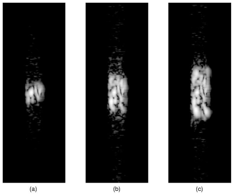 Fig. 12