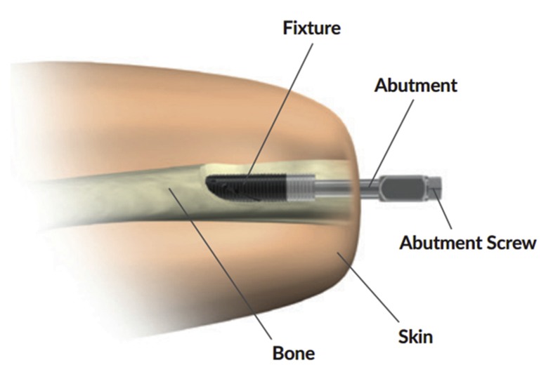 Fig. 1