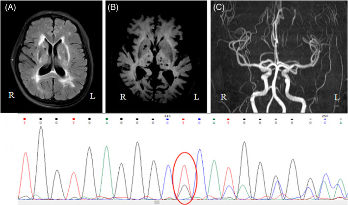 FIGURE 1