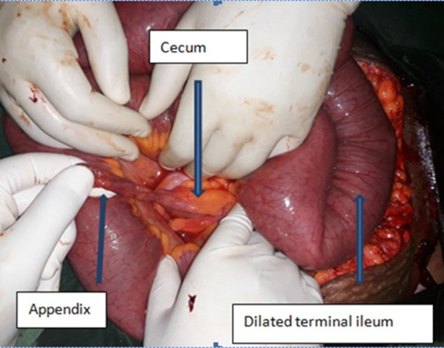 Figure 2: