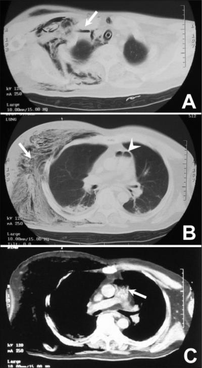 FIG. 1.