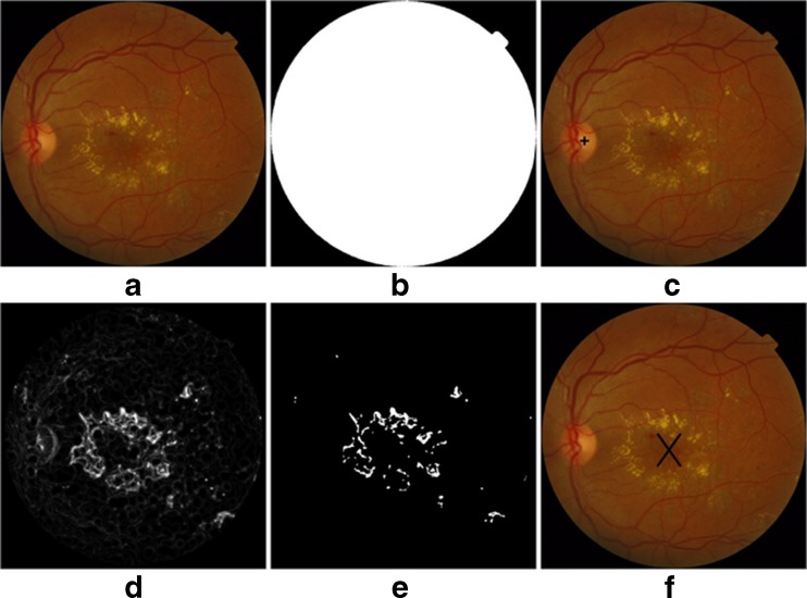 Fig. 4