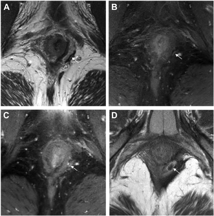 Fig. 3