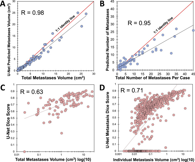 Relationship between manually segmented metastasis volume or number and U-Net–predicted volume or number and Dice scores. A, Scatterplot and Pearson correlation between manually segmented tumor volume and U-Net–predicted tumor volume. B, Scatterplot and Pearson correlation between manually segmented number of metastases per case and predicted number of metastases per case. Scatterplot and Pearson correlation between log10-transformed volumes and Dice scores for, C, individual patients and, D, individual brain metastases.