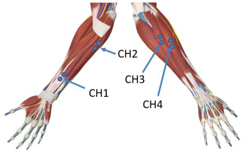 Figure 2