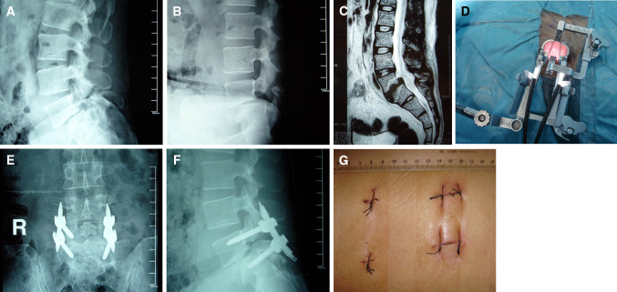 Fig. 1