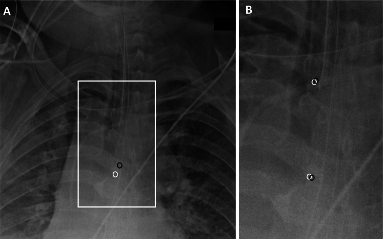 Fig. 4