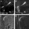 FIG. 18