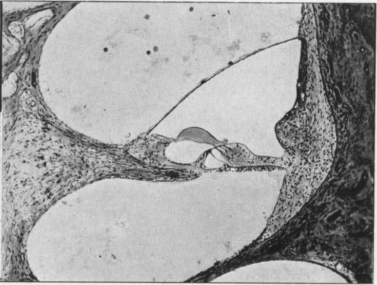 Fig. 9b