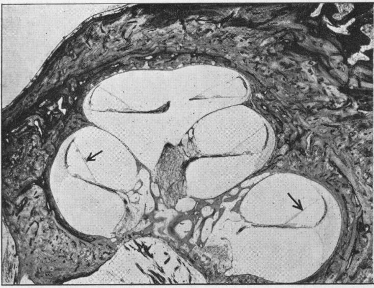 Fig. 4a