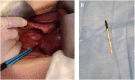 Fig. 4