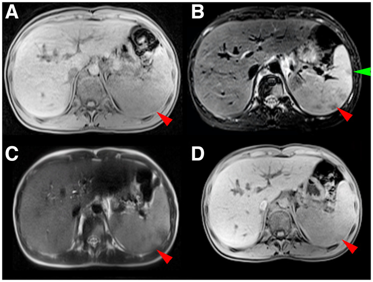 FIGURE 4.