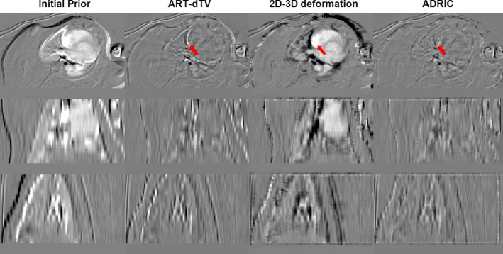 Figure 10