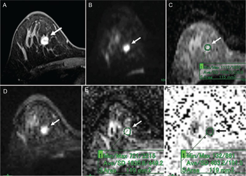 Fig 4.