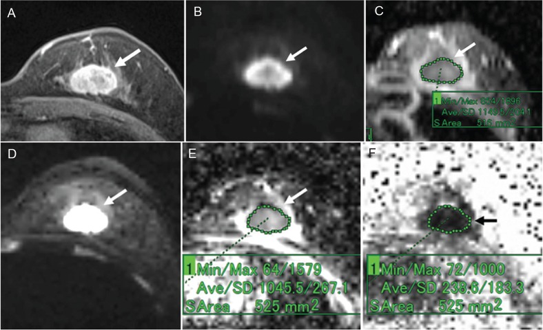 Fig 6.