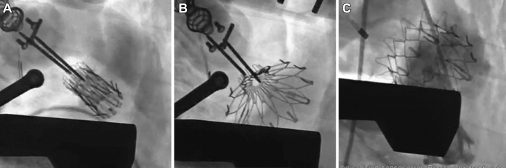 Figure 4