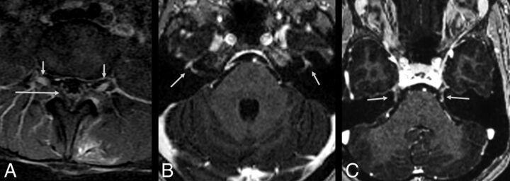 Fig 2.