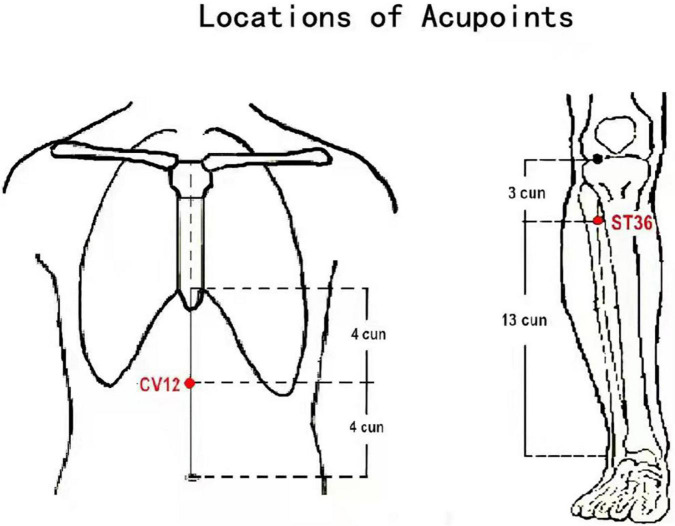 FIGURE 1