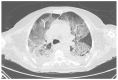 Figure 4 -