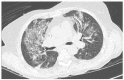 Figure 3 -