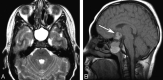 Fig 2.