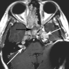 Fig 5.