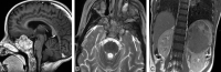 Fig 13.