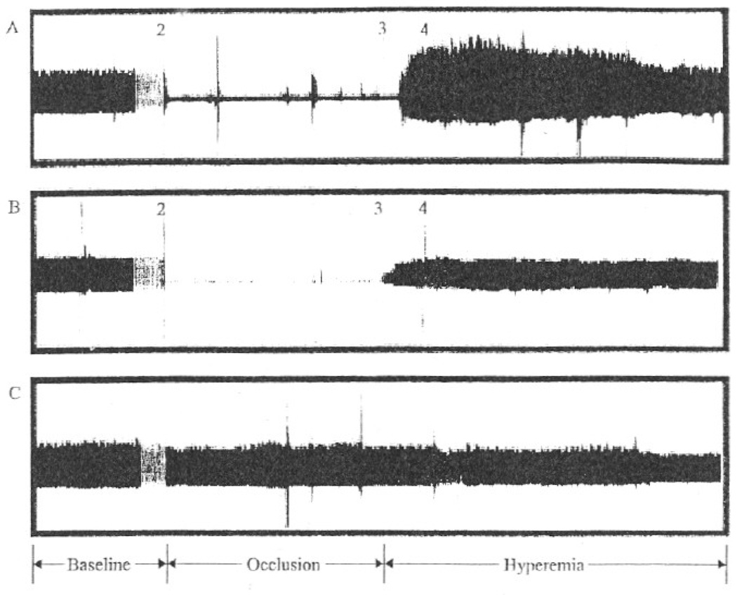 FIG. 1