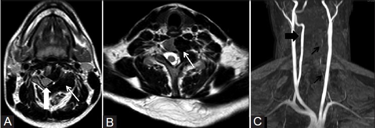 Figure 3(A-C)