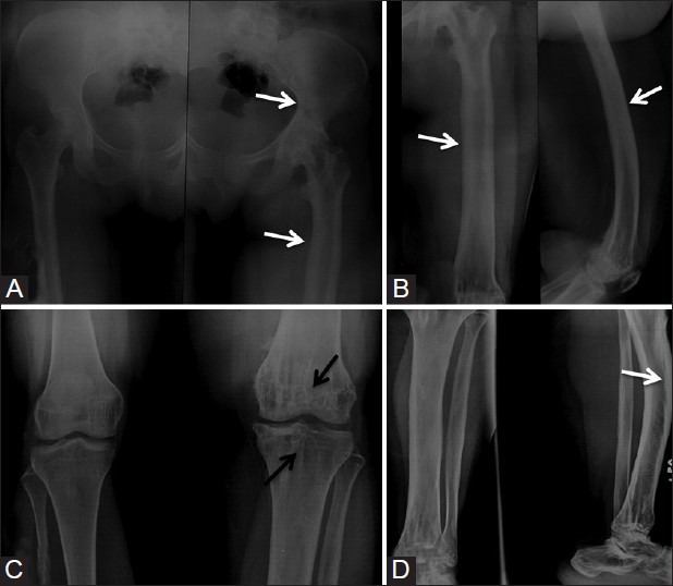 Figure 5(A-D)