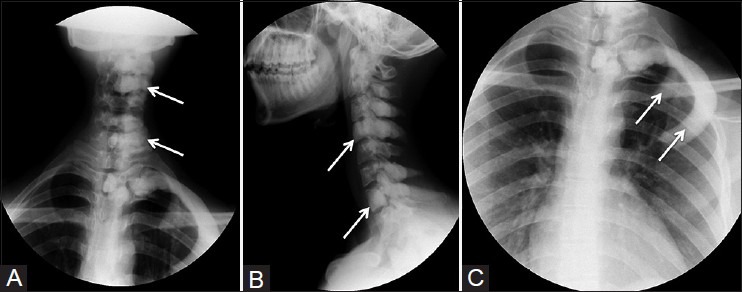 Figure 1(A-C)