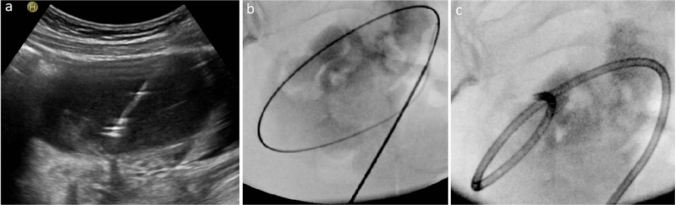 Fig. 2