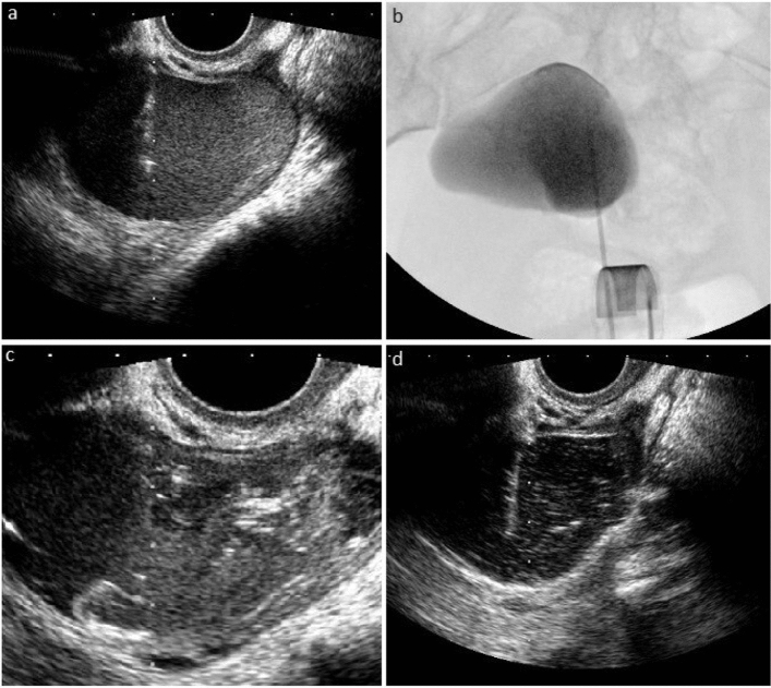 Fig. 1