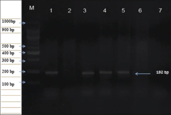 Figure-4