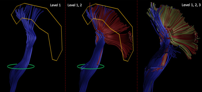 Fig. 4